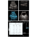 DW-500 laptop ultrasound scanner & ultrasound machine with battery